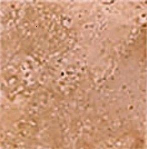 Вставка Bottone Marmo Scabos 4.8*4.8